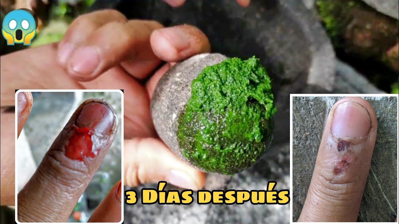 plantas para cicatrizar heridas en la piel