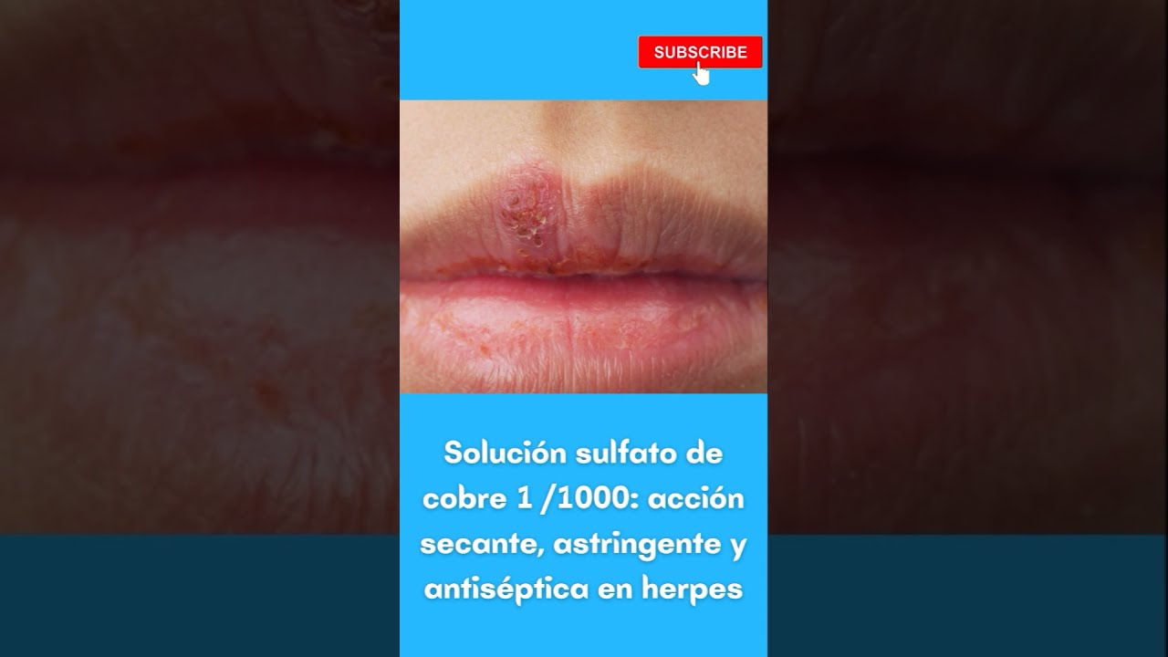 sulfato de cobre para la piel
