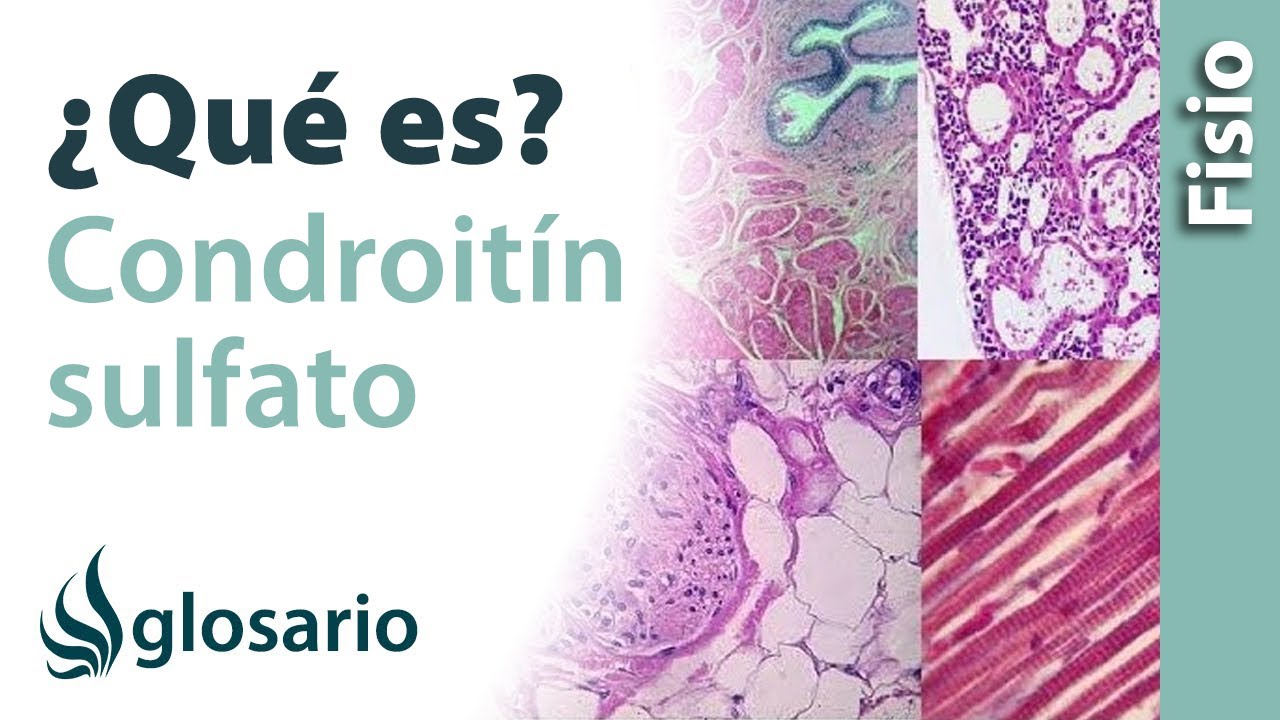 sulfato de condroitina para que sirve